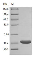 Recombinant Human Superoxide dismutase [Cu-Zn] (SOD1) (Active) – Figure 1 of 1