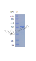 Recombinant Human SPARC protein (SPARC) (Active) – Figure 1 of 1
