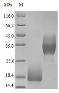 Recombinant Human Trefoil factor 3 protein (TFF3) (Active) – Figure 1 of 1