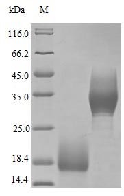 Recombinant Human Trefoil factor 3 protein (TFF3) (Active) – Figure 1 of 1