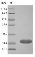 Recombinant Human Neutrophil gelatinase-associated lipocalin protein (LCN2) (Active) – Figure 1 of 1