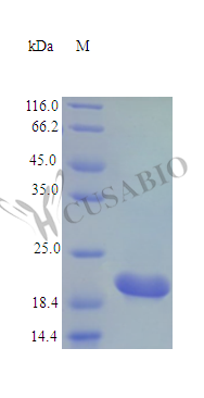 Recombinant Mouse Cardiotrophin-1 protein (Ctf1) (Active) – Figure 1 of 1
