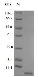 Recombinant Human Stromal cell-derived factor 1 protein (CXCL12), partial (Active) – Figure 1 of 1