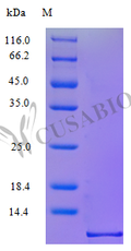 Recombinant Human C-C motif chemokine 1 protein (CCL1), partial (Active) – Figure 1 of 1