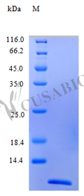 Recombinant Human C-C motif chemokine 13 protein (CCL13), partial (Active) – Figure 1 of 1