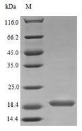 Recombinant Human Interleukin-17B protein (IL17B) (Active) – Figure 1 of 1