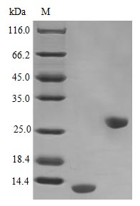 Recombinant Human Interleukin-5 protein (IL5) (Active) – Figure 1 of 1
