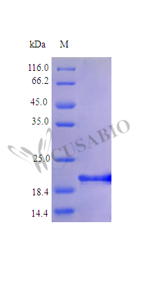 Recombinant Human Interleukin-6 protein (IL6) (Active) – Figure 1 of 1