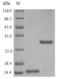 Recombinant Human Interleukin-17A protein (IL17A) (Active) – Figure 1 of 1