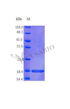Recombinant Human Tumor necrosis factor protein (TNF), partial (Active)