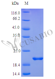 Recombinant Human Oncostatin-M protein (OSM), partial (Active) – Figure 1 of 1