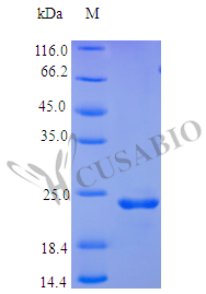 Recombinant Human Oncostatin-M protein (OSM), partial (Active) – Figure 1 of 1