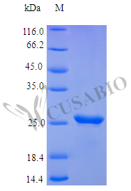 Recombinant Human Oncostatin-M protein (OSM), partial (Active) – Figure 1 of 1