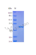 Recombinant Human Plasminogen protein (PLG), partial (Active) – Figure 1 of 1