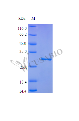 Recombinant Human Plasminogen protein (PLG), partial (Active) – Figure 1 of 1