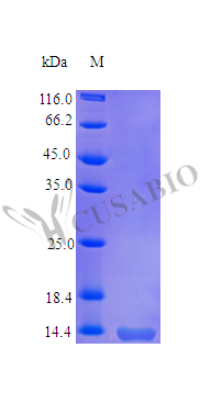 Recombinant Human Tumor necrosis factor receptor superfamily member 10B (TNFRSF10B), partial (Active) – Figure 1 of 1