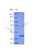 Recombinant Human Tumor necrosis factor receptor superfamily member 1A protein (TNFRSF1A), partial (Active) – Figure 1 of 1