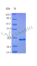 Recombinant Human Fibroblast growth factor 9 protein (FGF9), partial (Active) – Figure 1 of 1