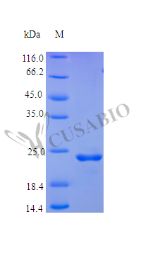 Recombinant Human Fibroblast growth factor 9 protein (FGF9), partial (Active) – Figure 1 of 1