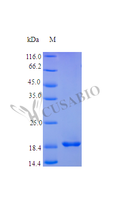 Recombinant Human Fibroblast growth factor 21 protein (FGF21) (Active) – Figure 1 of 1