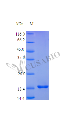Recombinant Human Fibroblast growth factor 21 protein (FGF21) (Active) – Figure 1 of 1