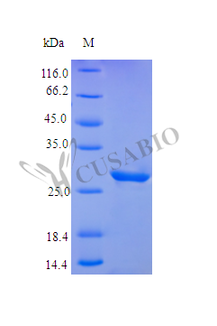Recombinant Human Insulin-like growth factor-binding protein 3 protein (IGFBP3) (Active)