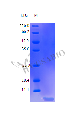 Recombinant Human Insulin-like growth factor I protein (IGF1), partial (Active) – Figure 1 of 1