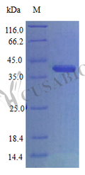 Recombinant Human CCN family member 1 (CCN1) (Active) – Figure 1 of 1