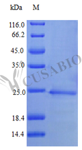 Recombinant Human Interferon alpha-1/13 (IFNA1) (Active) – Figure 1 of 1