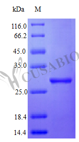 Recombinant Human Interferon alpha-2 protein (IFNA2) (Active) – Figure 1 of 1