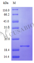 Recombinant Human Interferon alpha-2 protein (IFNA2), partial (Active) – Figure 1 of 1