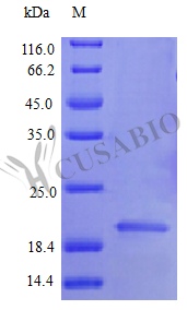 Recombinant Human Interferon alpha-2 protein (IFNA2) (Active) – Figure 1 of 1