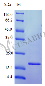 Recombinant Human Interferon omega-1 protein (IFNW1), partial (Active) – Figure 1 of 1