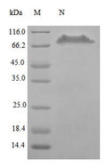 Recombinant Human Tumor necrosis factor receptor superfamily member 11B protein (TNFRSF11B), partial (Active) – Figure 1 of 1