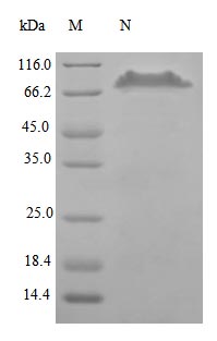 Recombinant Human Tumor necrosis factor receptor superfamily member 11B protein (TNFRSF11B), partial (Active) – Figure 1 of 1