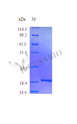 Recombinant Mouse Interleukin-11 protein (Il11) (Active)