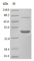Recombinant Mouse Macrophage colony-stimulating factor 1 protein (Csf1), partial (Active) – Figure 1 of 1