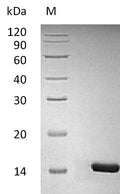 (Tris-Glycine gel) Discontinuous SDS-PAGE (reduced) with 5% enrichment gel and 15% separation gel.