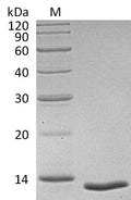 (Tris-Glycine gel) Discontinuous SDS-PAGE (reduced) with 5% enrichment gel and 15% separation gel.