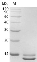 (Tris-Glycine gel) Discontinuous SDS-PAGE (reduced) with 5% enrichment gel and 15% separation gel.