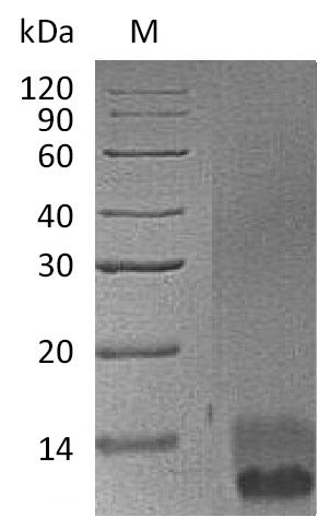 (Tris-Glycine gel) Discontinuous SDS-PAGE (reduced) with 5% enrichment gel and 15% separation gel.