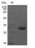 (Tris-Glycine gel) Discontinuous SDS-PAGE (reduced) with 5% enrichment gel and 15% separation gel.