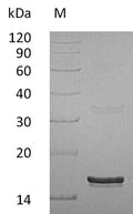 (Tris-Glycine gel) Discontinuous SDS-PAGE (reduced) with 5% enrichment gel and 15% separation gel.