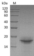 (Tris-Glycine gel) Discontinuous SDS-PAGE (reduced) with 5% enrichment gel and 15% separation gel.