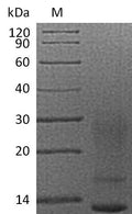 (Tris-Glycine gel) Discontinuous SDS-PAGE (reduced) with 5% enrichment gel and 15% separation gel.