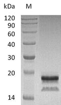 (Tris-Glycine gel) Discontinuous SDS-PAGE (reduced) with 5% enrichment gel and 15% separation gel.