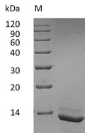 (Tris-Glycine gel) Discontinuous SDS-PAGE (reduced) with 5% enrichment gel and 15% separation gel.