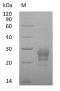 (Tris-Glycine gel) Discontinuous SDS-PAGE (reduced) with 5% enrichment gel and 15% separation gel.