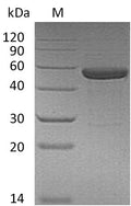 (Tris-Glycine gel) Discontinuous SDS-PAGE (reduced) with 5% enrichment gel and 15% separation gel.
