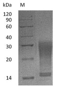 (Tris-Glycine gel) Discontinuous SDS-PAGE (reduced) with 5% enrichment gel and 15% separation gel.